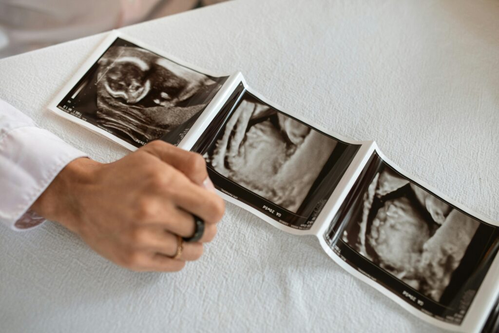 Ultrasound photos of baby in womb Ultrasound sonogram image of baby as it relates to health of baby in womb and exposure to EMF with the risk of miscarriage.